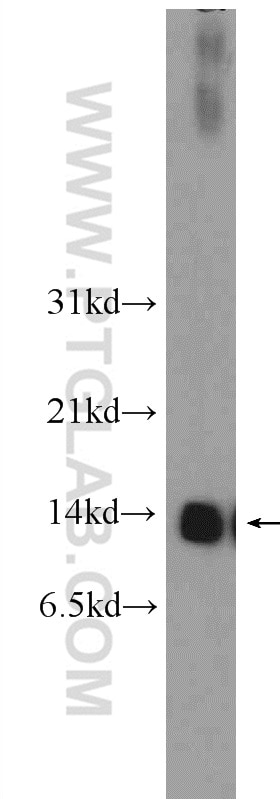 Western Blot (WB) analysis of rat liver tissue using NDUFS6 Polyclonal antibody (14417-1-AP)