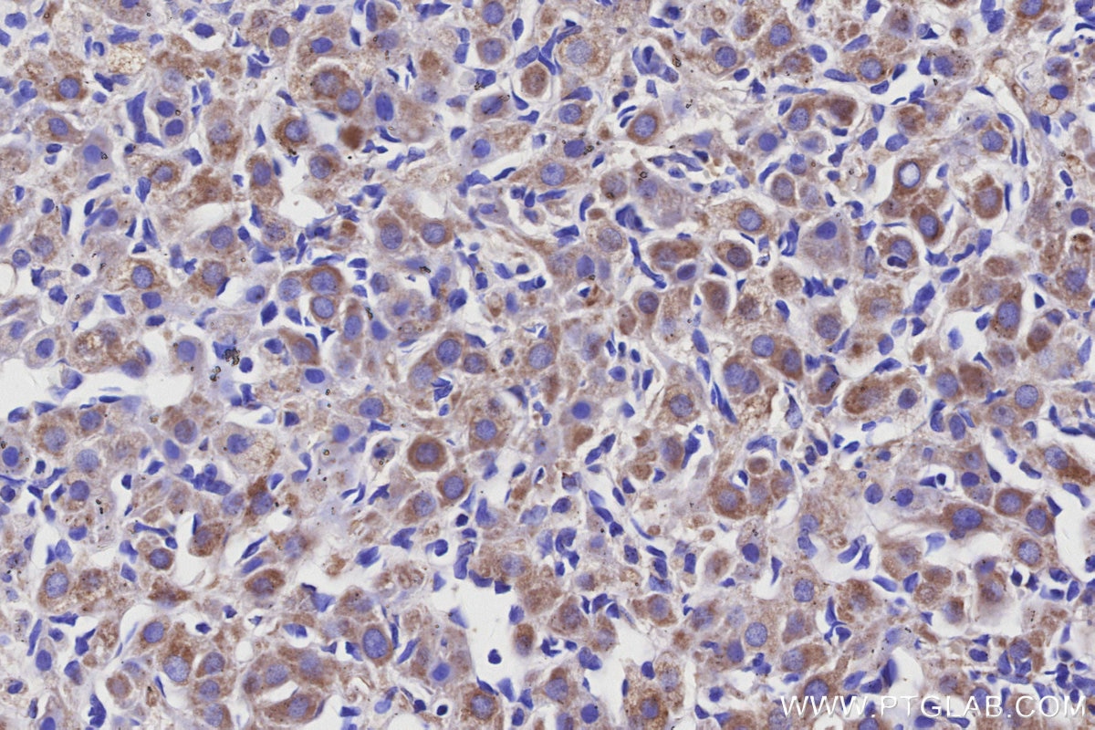 Immunohistochemistry (IHC) staining of rat ovary tissue using NDUFS6 Monoclonal antibody (68329-1-Ig)