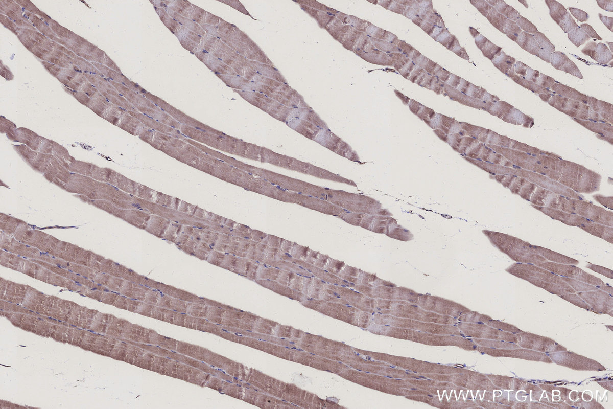 IHC staining of mouse skeletal muscle using 15728-1-AP Immunohistochemistry (IHC) staining of mouse skeletal muscle tissue using NDUFS7 Polyclonal antibody (15728-1-AP)