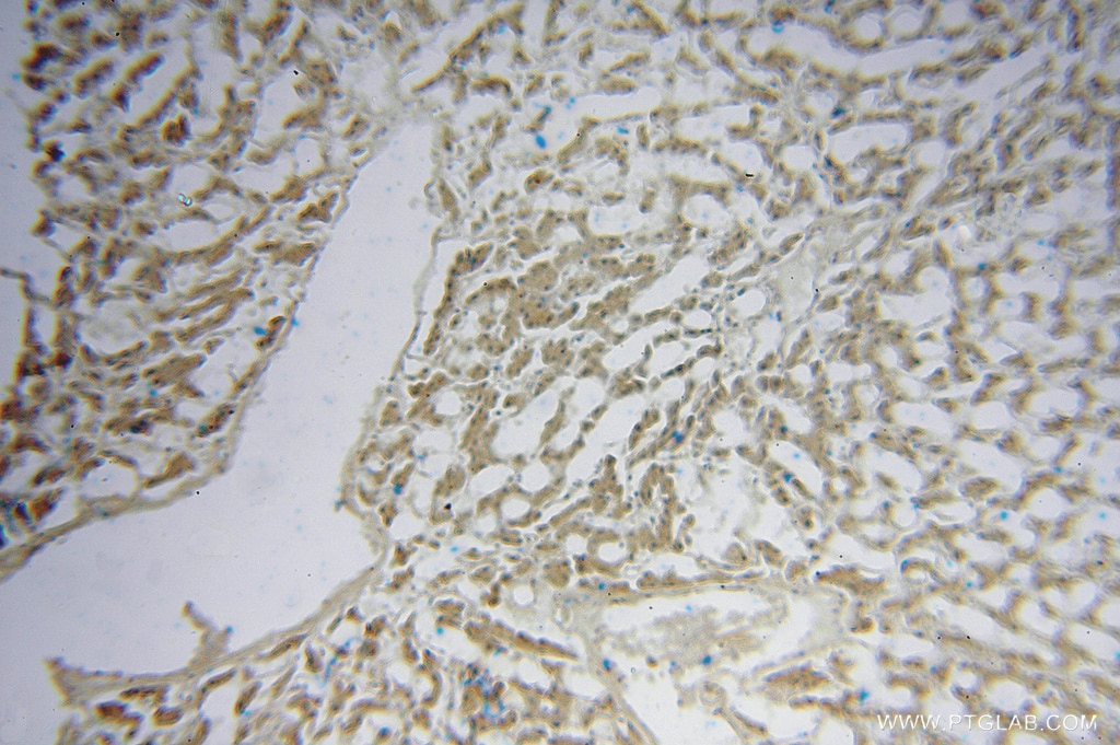 Immunohistochemistry (IHC) staining of human liver tissue using NDUFS7 Polyclonal antibody (15728-1-AP)