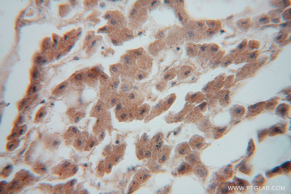 Immunohistochemistry (IHC) staining of human liver tissue using NDUFS7 Polyclonal antibody (15728-1-AP)