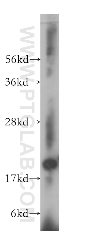 Western Blot (WB) analysis of human brain tissue using NDUFS7 Polyclonal antibody (15728-1-AP)