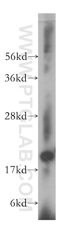 WB analysis of human brain using 15728-1-AP