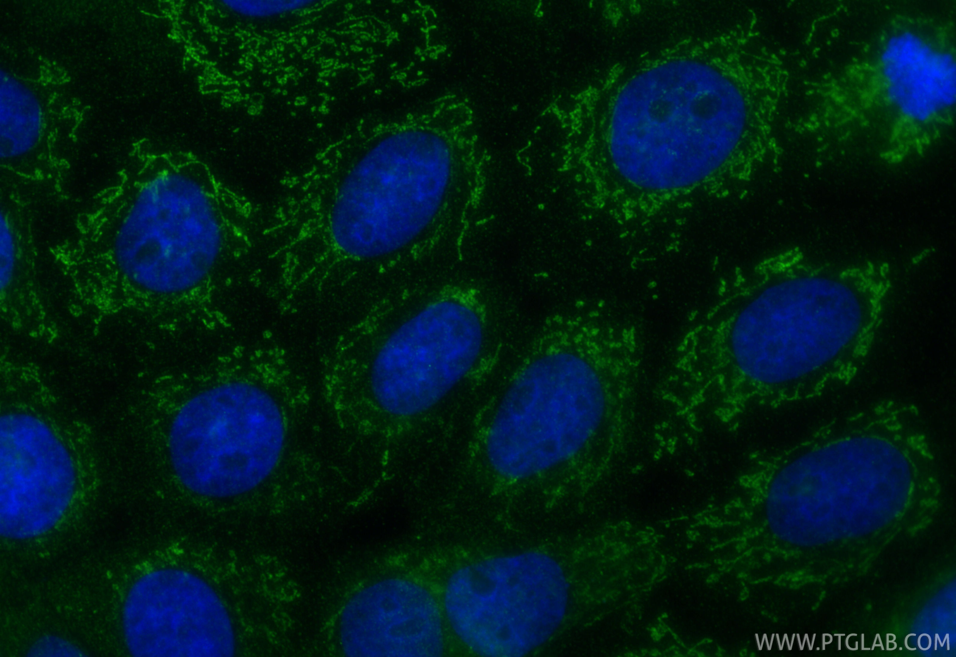 Immunofluorescence (IF) / fluorescent staining of A431 cells using NDUFS8 Polyclonal antibody (25172-1-AP)