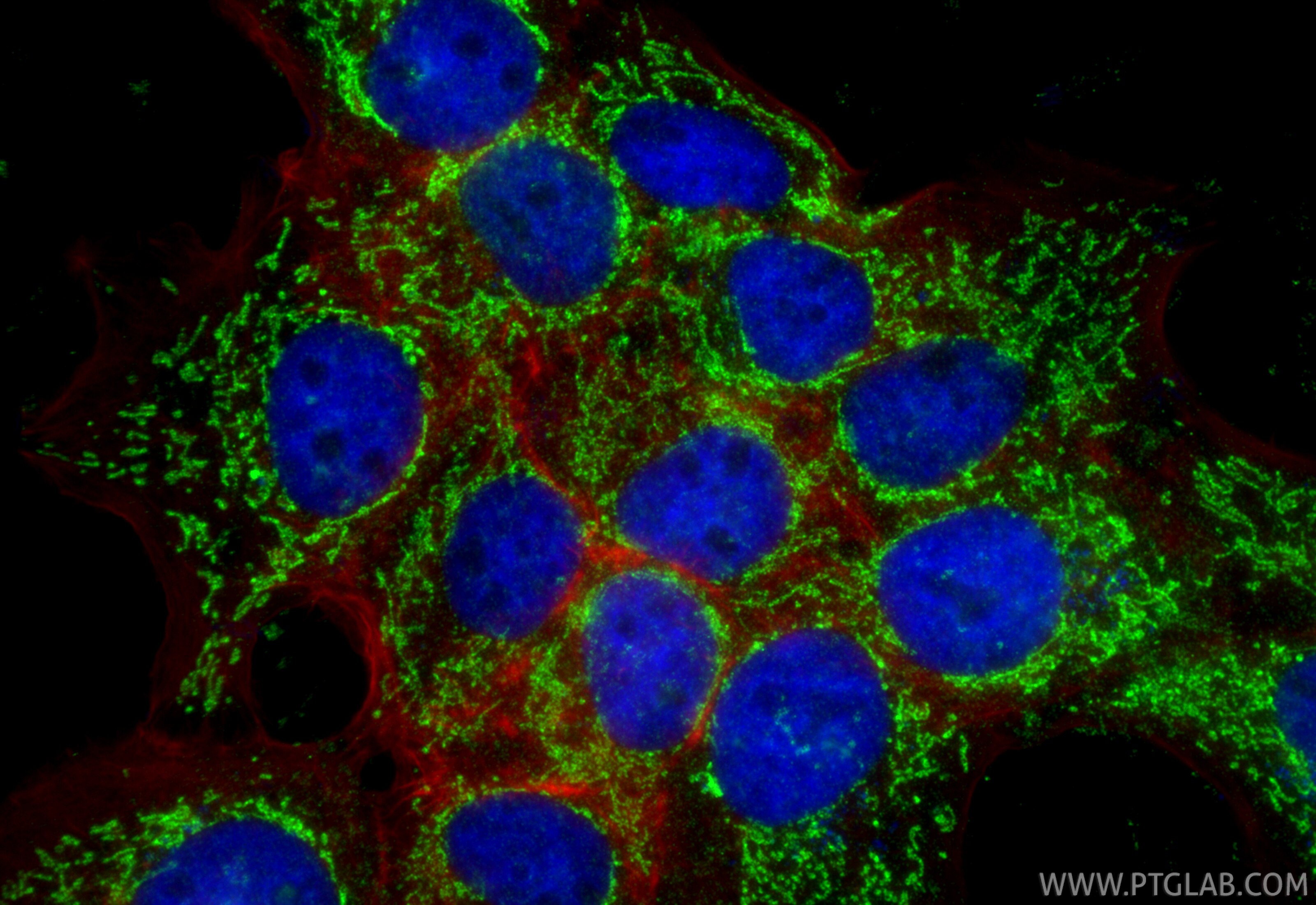 Immunofluorescence (IF) / fluorescent staining of A431 cells using NDUFS8 Polyclonal antibody (25172-1-AP)