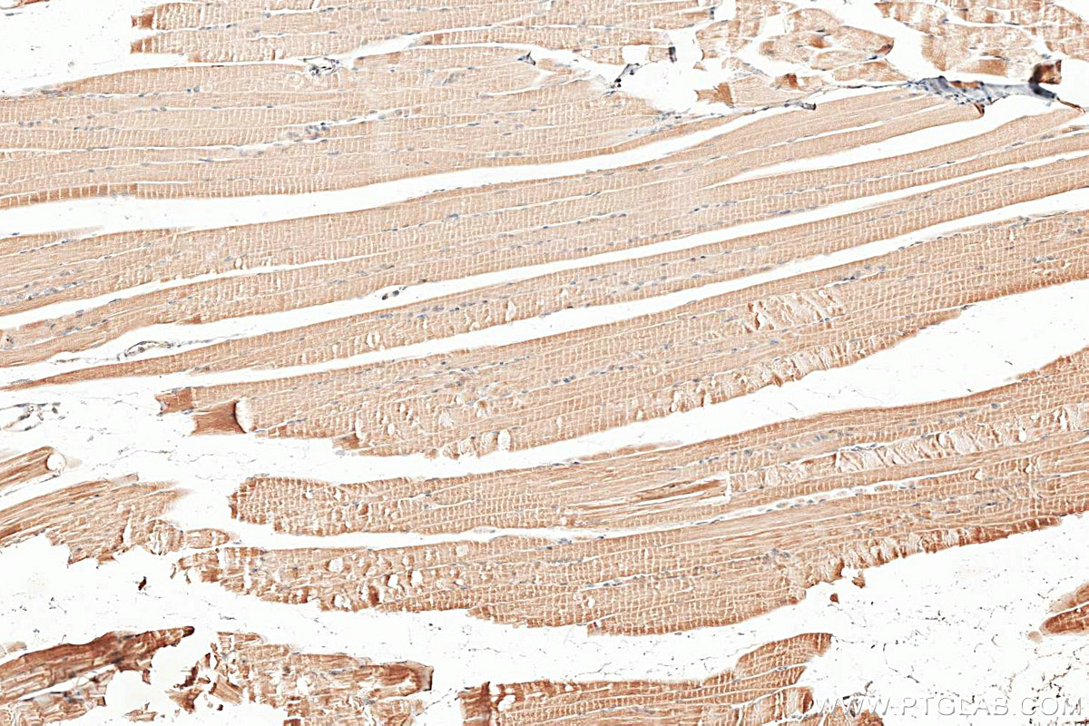 Immunohistochemistry (IHC) staining of mouse skeletal muscle tissue using NDUFS8 Polyclonal antibody (25172-1-AP)