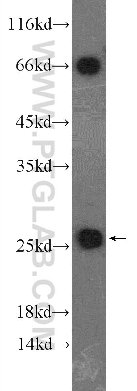 Western Blot (WB) analysis of mouse heart tissue using NDUFS8 Polyclonal antibody (25172-1-AP)