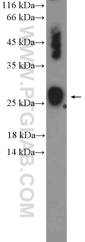 Western Blot (WB) analysis of mouse brain tissue using NDUFS8 Polyclonal antibody (25172-1-AP)