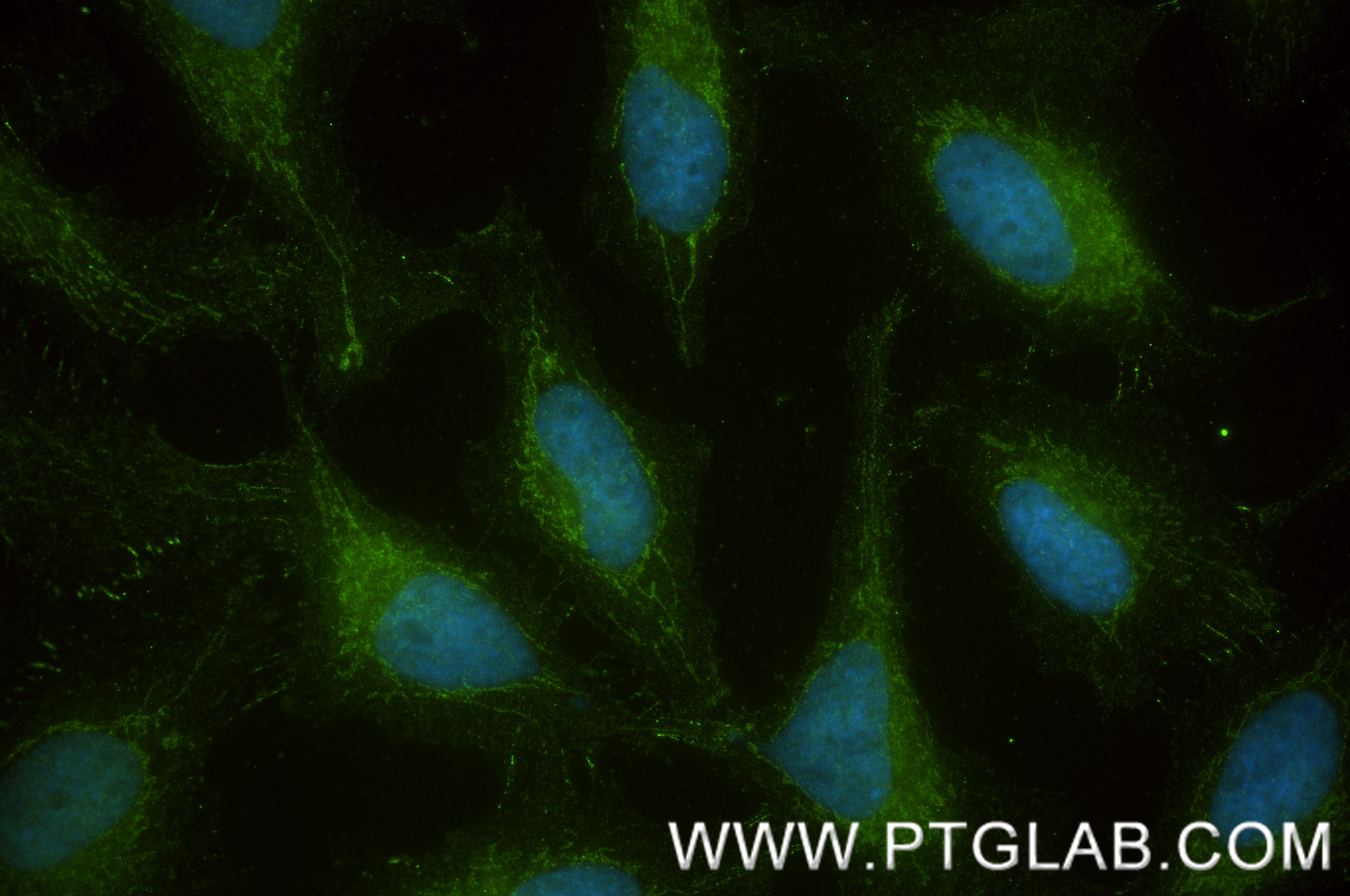 IF Staining of HeLa using 87156-1-RR Immunofluorescence (IF) / fluorescent staining of HeLa cells using NDUFS8 Recombinant monoclonal antibody (87156-1-RR)