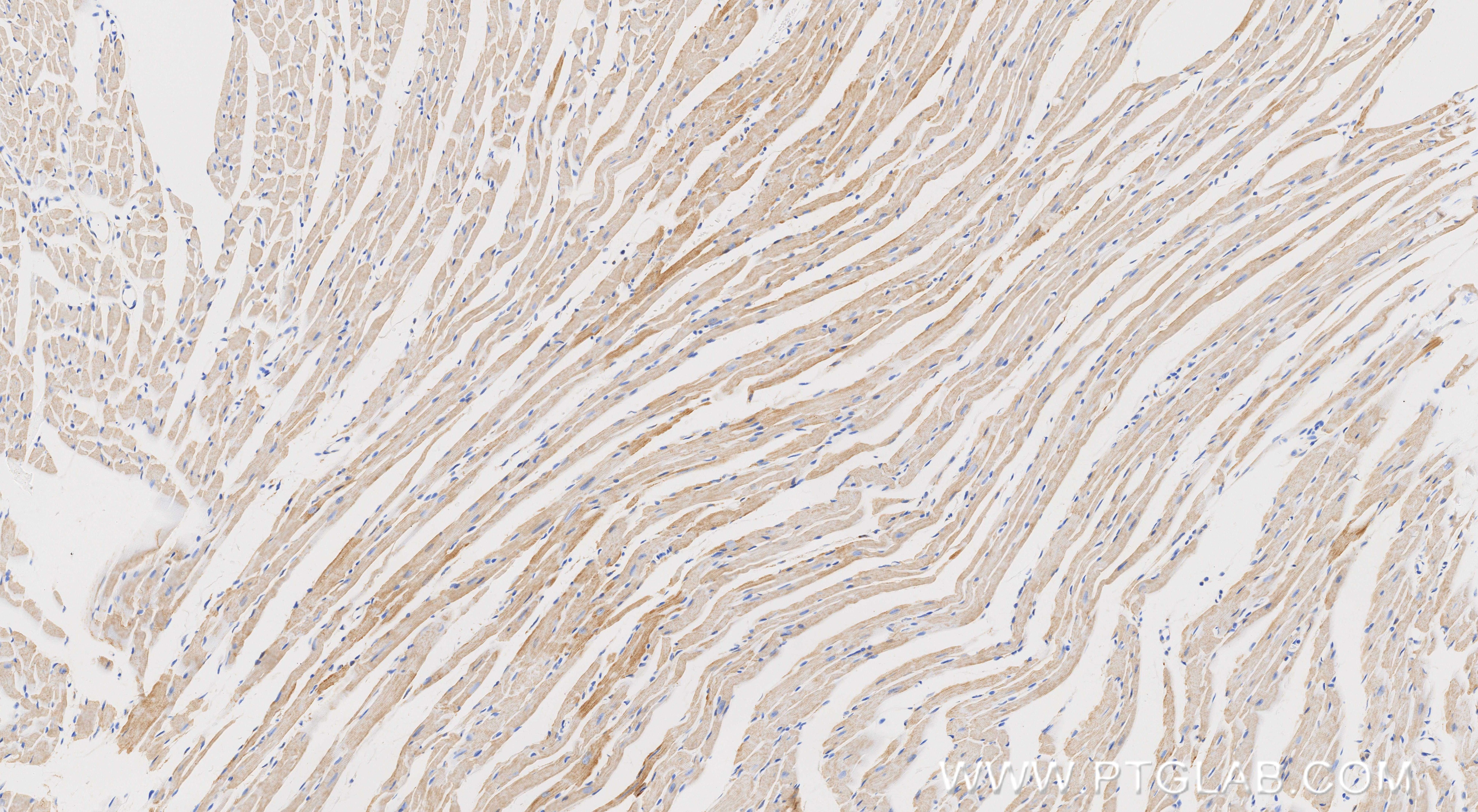 IHC staining of mouse heart using 87156-1-RR Immunohistochemistry (IHC) staining of mouse heart tissue using NDUFS8 Recombinant monoclonal antibody (87156-1-RR)