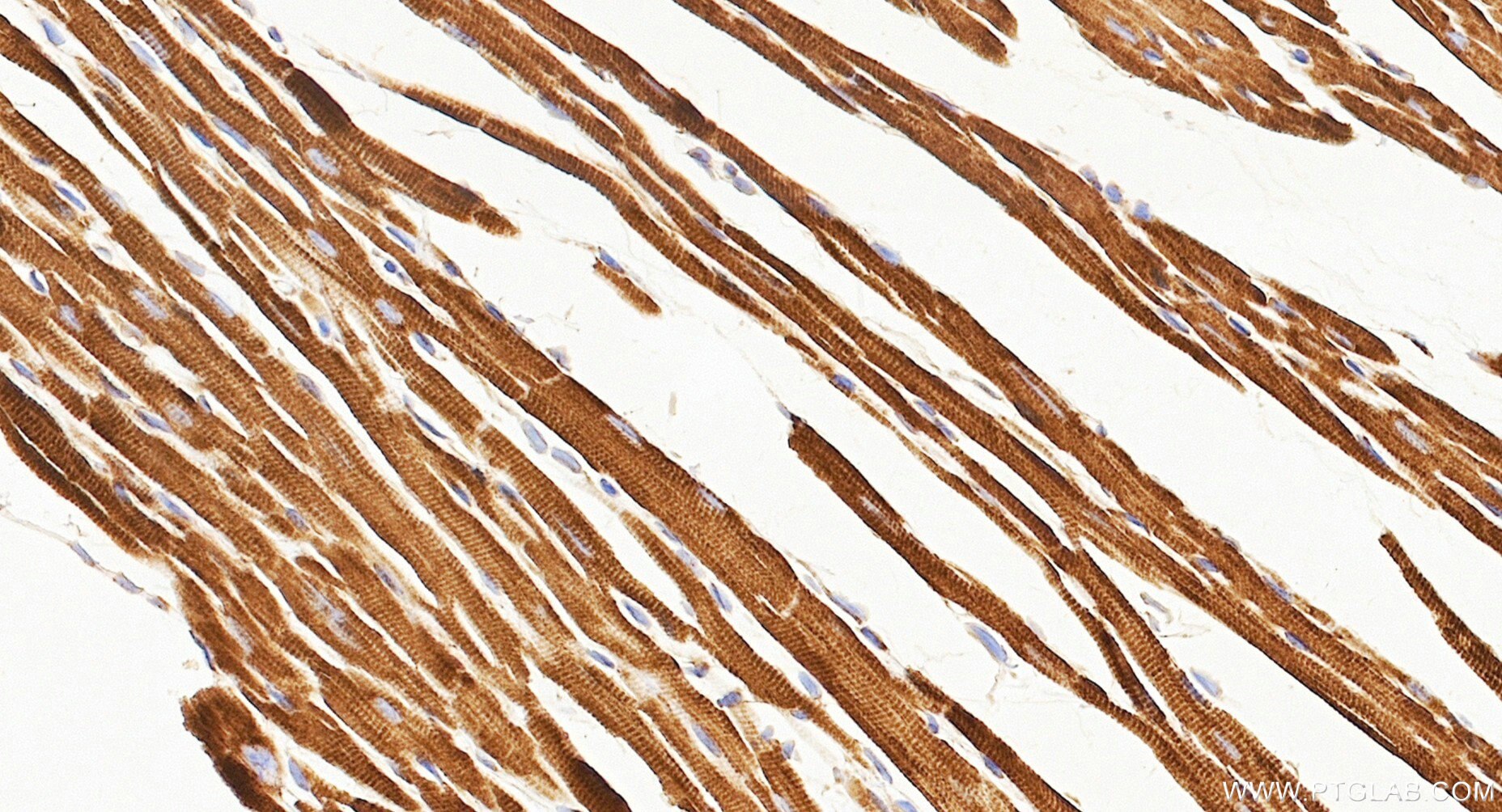 IHC staining of mouse heart using Biotin-87156 Immunohistochemistry (IHC) staining of mouse heart tissue using Biotin-conjugated NDUFS8 Recombinant monoclonal an (Biotin-87156)