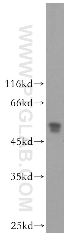 NDUFV1 Polyclonal antibody