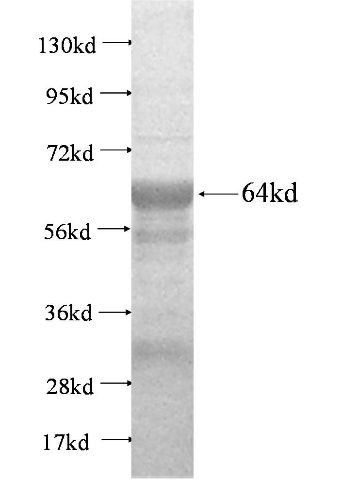 NDUFV1 fusion protein Ag1764 SDS-PAGE