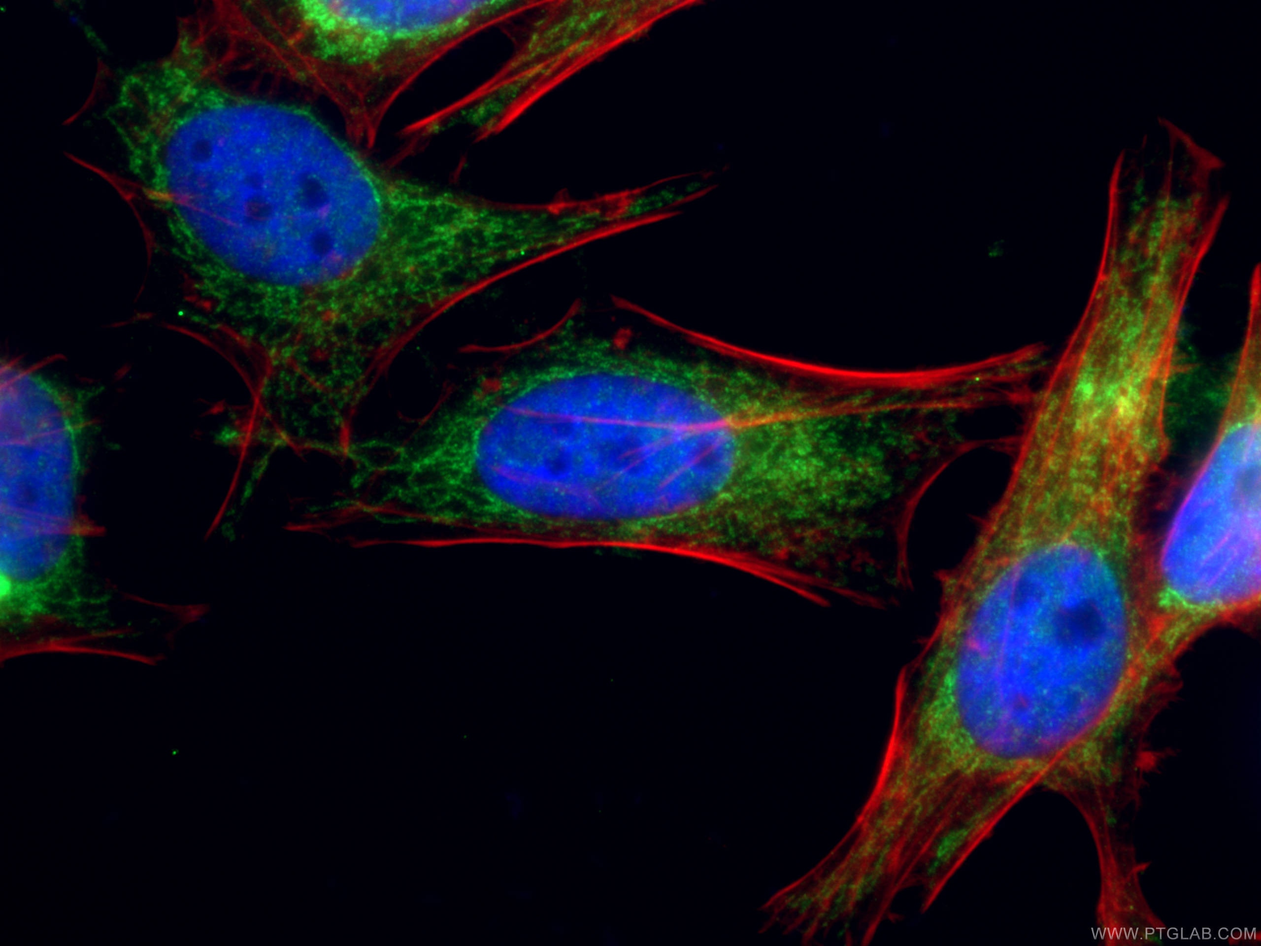 Immunofluorescence (IF) / fluorescent staining of HeLa cells using NDUFV2 Polyclonal antibody (15301-1-AP)