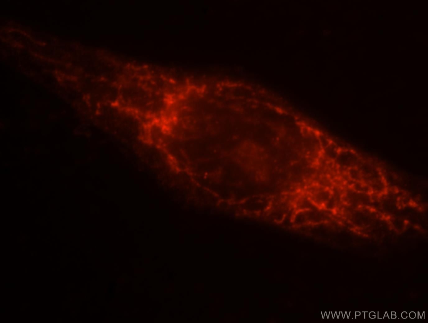 IF Staining of HeLa using 15301-1-AP