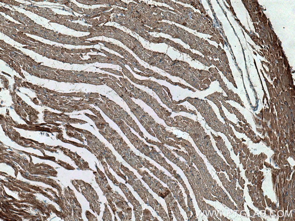 Immunohistochemistry (IHC) staining of mouse heart tissue using NDUFV2 Polyclonal antibody (15301-1-AP)