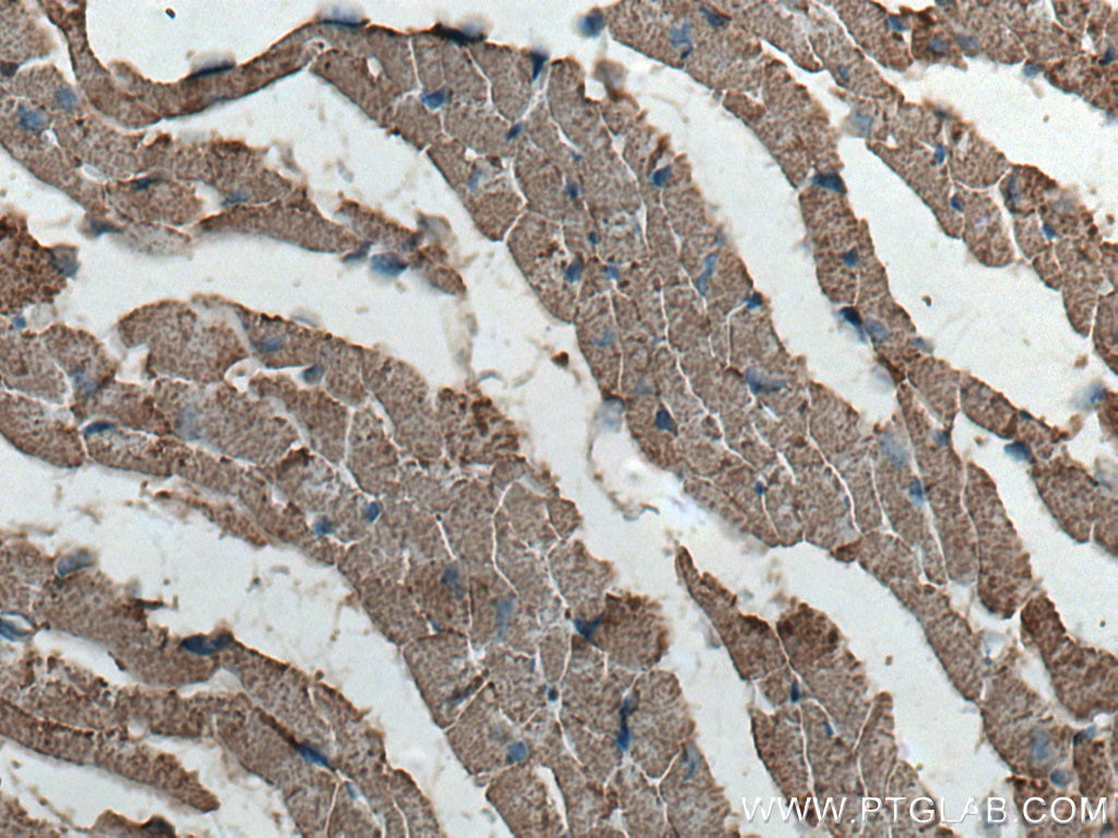 Immunohistochemistry (IHC) staining of mouse heart tissue using NDUFV2 Polyclonal antibody (15301-1-AP)