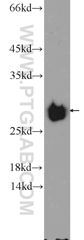 Western Blot (WB) analysis of rat skeletal muscle tissue using NDUFV2 Polyclonal antibody (15301-1-AP)