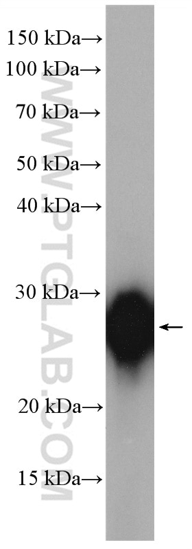 Western Blot (WB) analysis of rat heart tissue using NDUFV2 Polyclonal antibody (15301-1-AP)