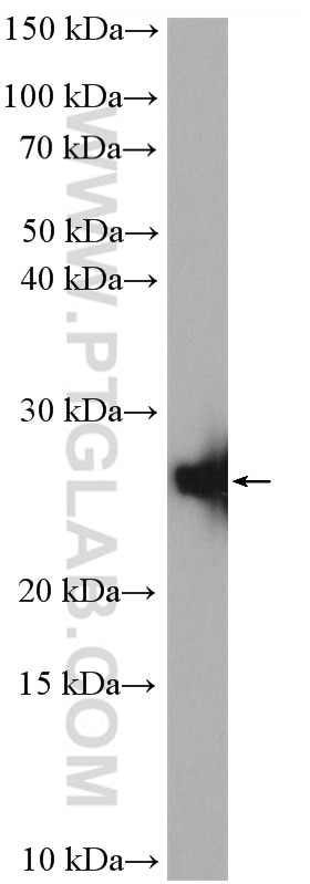 Western Blot (WB) analysis of mouse heart tissue using NDUFV2 Polyclonal antibody (15301-1-AP)