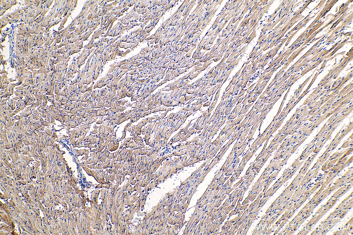 Immunohistochemistry (IHC) staining of mouse heart tissue using NDUFV2 Monoclonal antibody (68150-1-Ig)