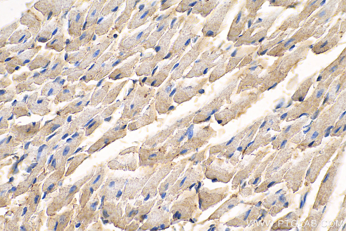 Immunohistochemistry (IHC) staining of mouse heart tissue using NDUFV2 Monoclonal antibody (68150-1-Ig)
