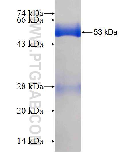 NDUFV2 fusion protein Ag7559 SDS-PAGE
