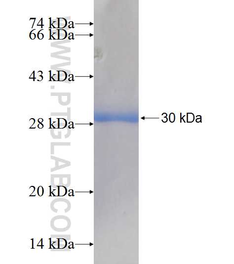 NDUFV2 fusion protein Ag7760 SDS-PAGE