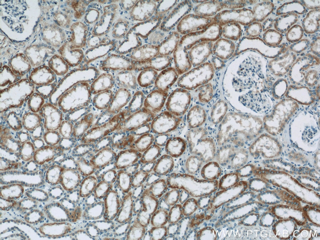 Immunohistochemistry (IHC) staining of human kidney tissue using NDUFV3 Polyclonal antibody (13430-1-AP)