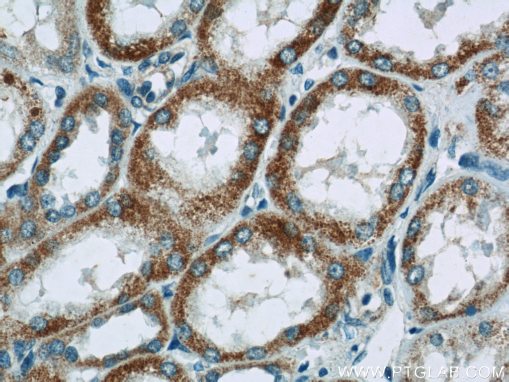 Immunohistochemistry (IHC) staining of human kidney tissue using NDUFV3 Polyclonal antibody (13430-1-AP)