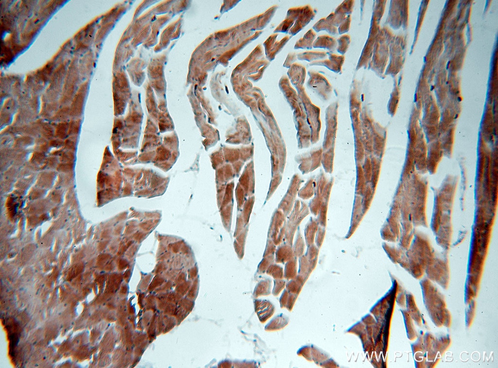 IHC staining of human skeletal muscle using 19706-1-AP