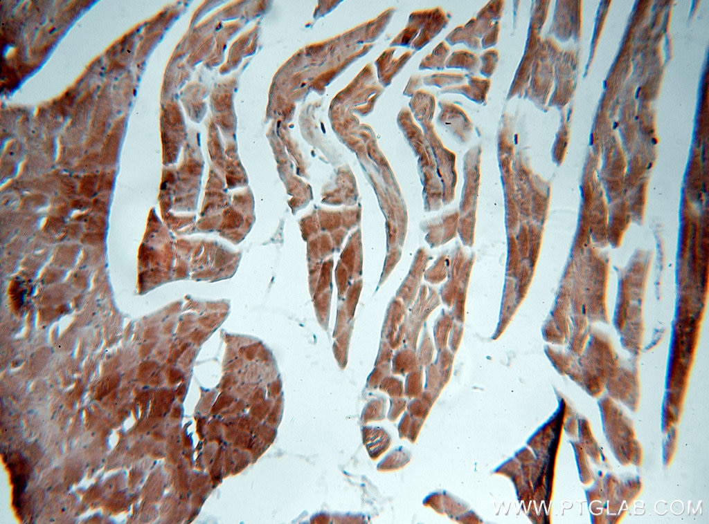 Immunohistochemistry (IHC) staining of human skeletal muscle tissue using NEB-Specific Polyclonal antibody (19706-1-AP)