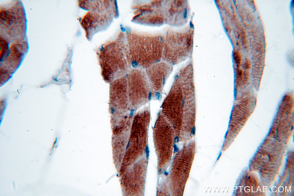 IHC staining of human skeletal muscle using 19706-1-AP