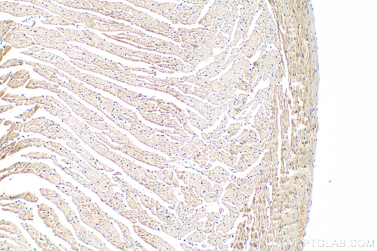 Immunohistochemistry (IHC) staining of mouse heart tissue using NEBL Polyclonal antibody (21497-1-AP)