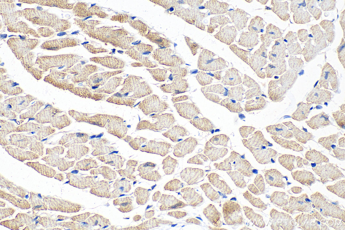 Immunohistochemistry (IHC) staining of mouse heart tissue using NEBL Polyclonal antibody (21497-1-AP)