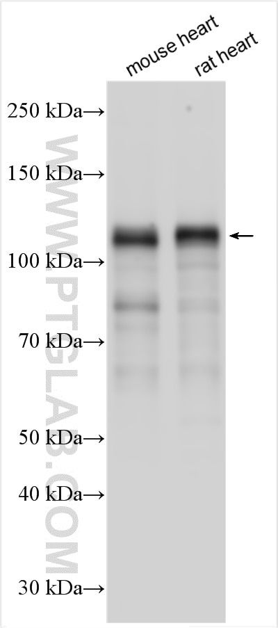 Western Blot (WB) analysis of various lysates using NEBL Polyclonal antibody (21497-1-AP)