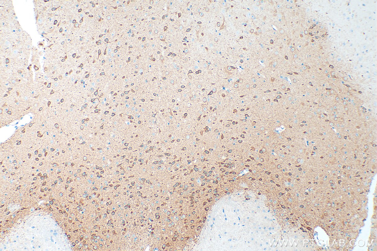 Immunohistochemistry (IHC) staining of mouse brain tissue using NECAB1 Polyclonal antibody (16477-1-AP)