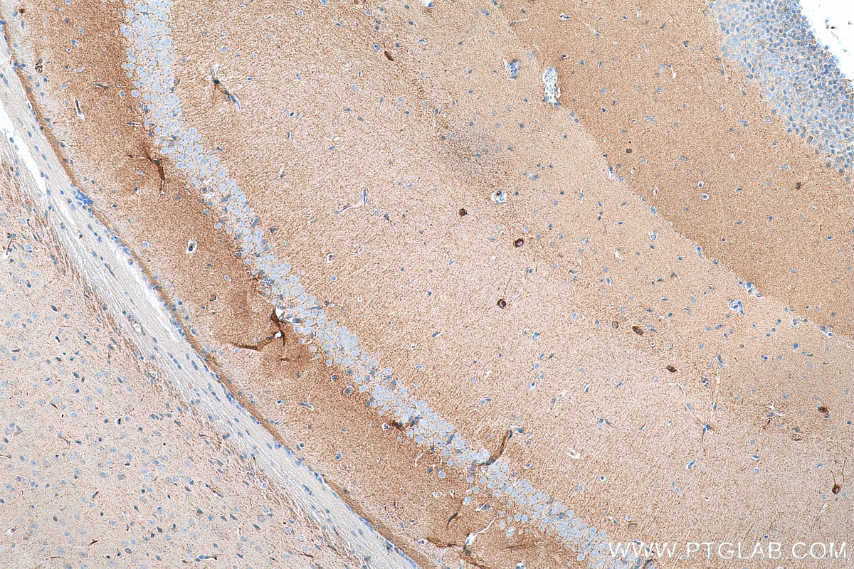 Immunohistochemistry (IHC) staining of mouse brain tissue using NECAB2 Polyclonal antibody (12257-1-AP)