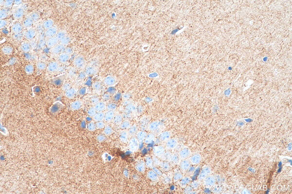 Immunohistochemistry (IHC) staining of mouse brain tissue using NECAB2 Polyclonal antibody (12257-1-AP)