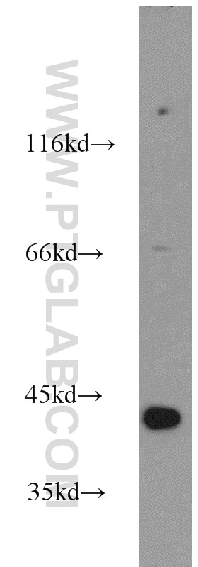 Western Blot (WB) analysis of human brain tissue using NECAB3 Polyclonal antibody (18940-1-AP)