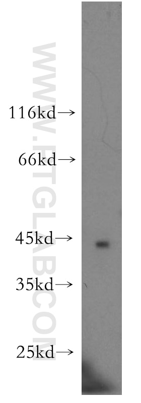 Western Blot (WB) analysis of human brain tissue using NECAB3 Polyclonal antibody (18940-1-AP)