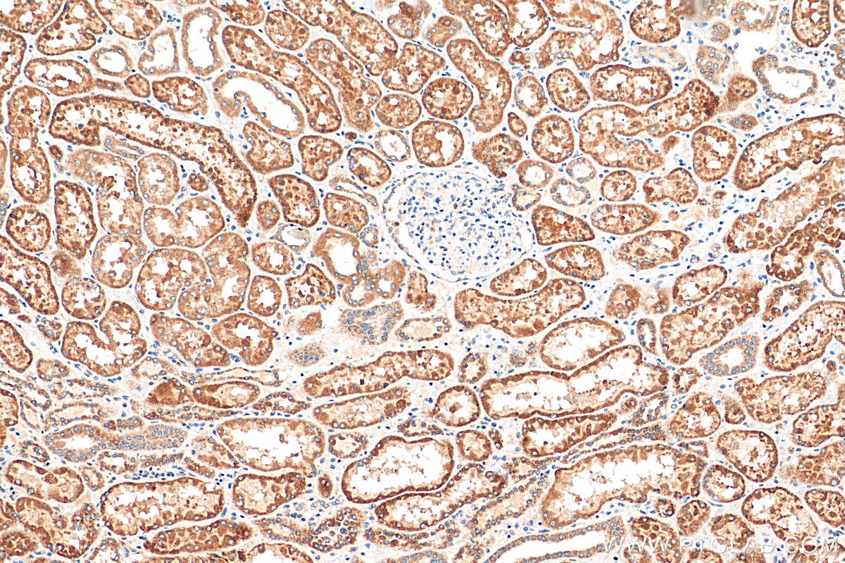 Immunohistochemistry (IHC) staining of human kidney tissue using NECAP1 Polyclonal antibody (17906-1-AP)