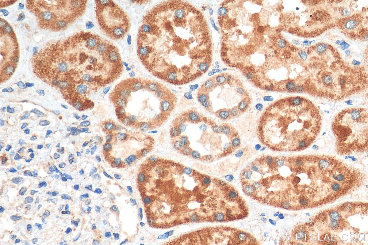 Immunohistochemistry (IHC) staining of human kidney tissue using NECAP1 Polyclonal antibody (17906-1-AP)
