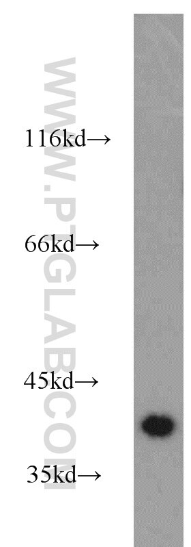 Western Blot (WB) analysis of human brain tissue using NECAP1 Polyclonal antibody (17906-1-AP)