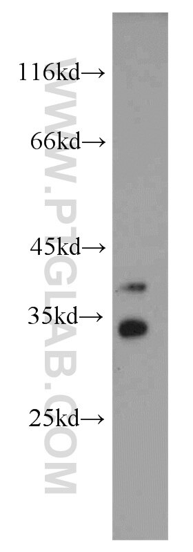 Western Blot (WB) analysis of human liver tissue using NECAP2 Polyclonal antibody (15899-1-AP)