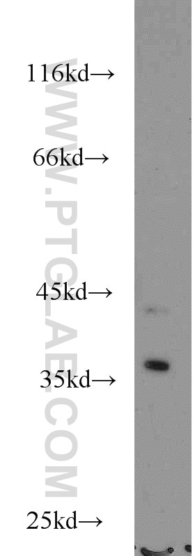 Western Blot (WB) analysis of MCF-7 cells using NECAP2 Polyclonal antibody (15899-1-AP)