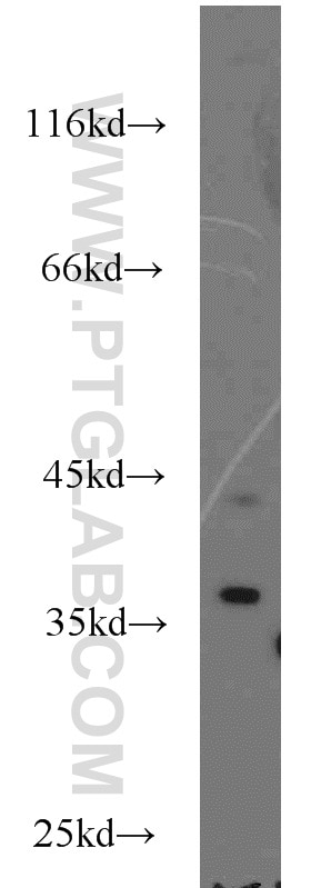 WB analysis of HeLa using 15899-1-AP