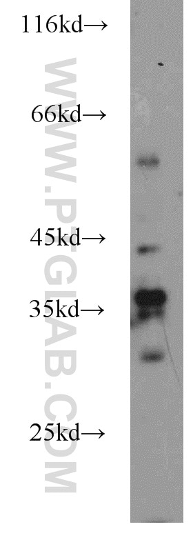 Western Blot (WB) analysis of mouse cerebellum tissue using NECAP2 Polyclonal antibody (15899-1-AP)
