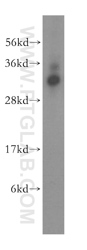 Western Blot (WB) analysis of human liver tissue using NECAP2 Polyclonal antibody (15899-1-AP)