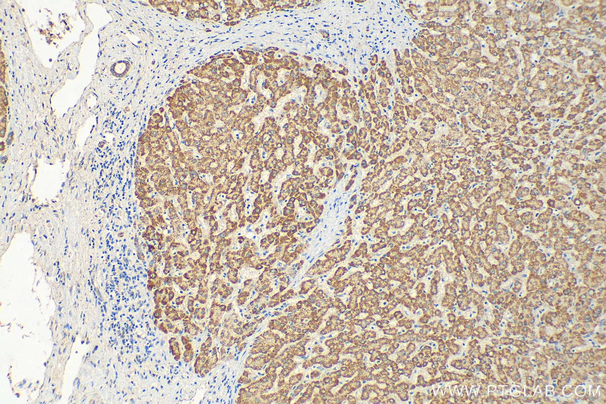 Immunohistochemistry (IHC) staining of human liver tissue using NEDD1 Polyclonal antibody (13993-1-AP)
